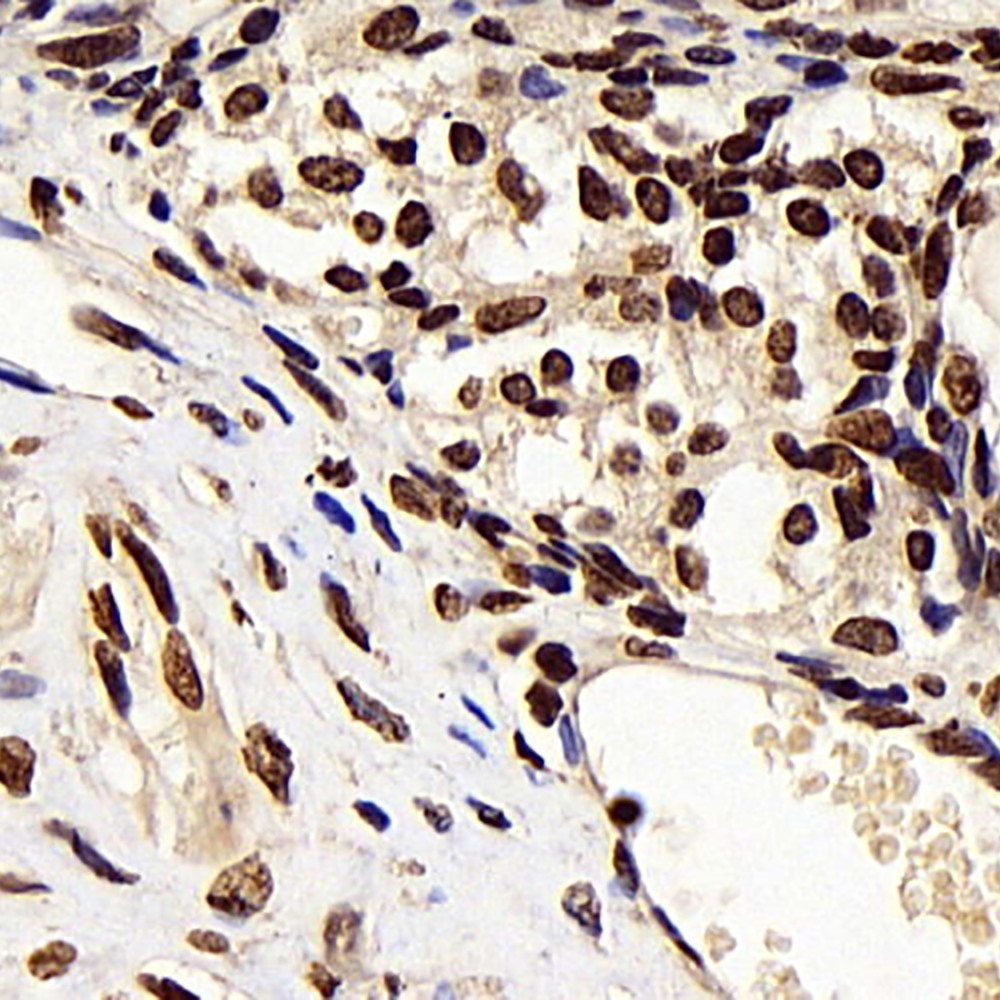 Immunohistochemistry analysis of paraffin-embedded rat ovary  using CDK4 Polyclonal Antibody at dilution of 1:100.