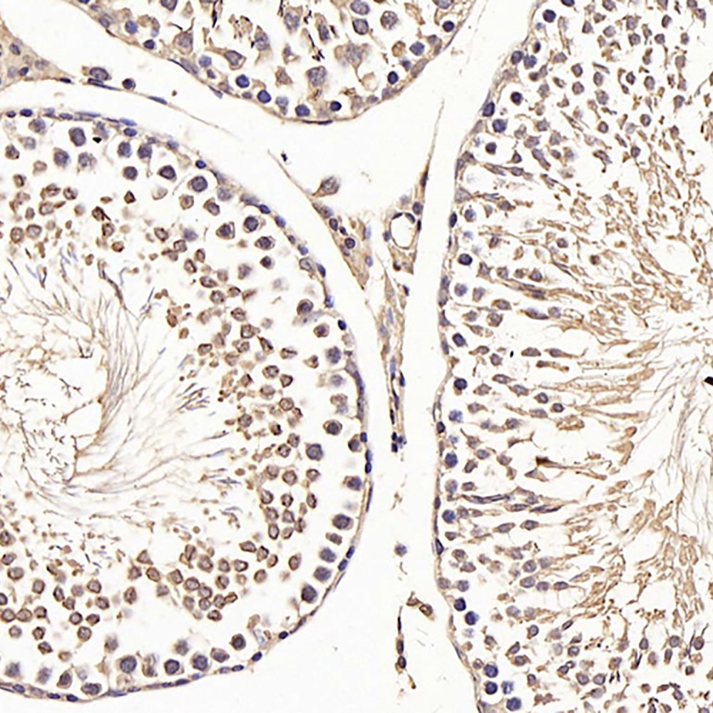 Immunohistochemistry analysis of paraffin-embedded rat testis  using CDK4 Polyclonal Antibody at dilution of 1:100.