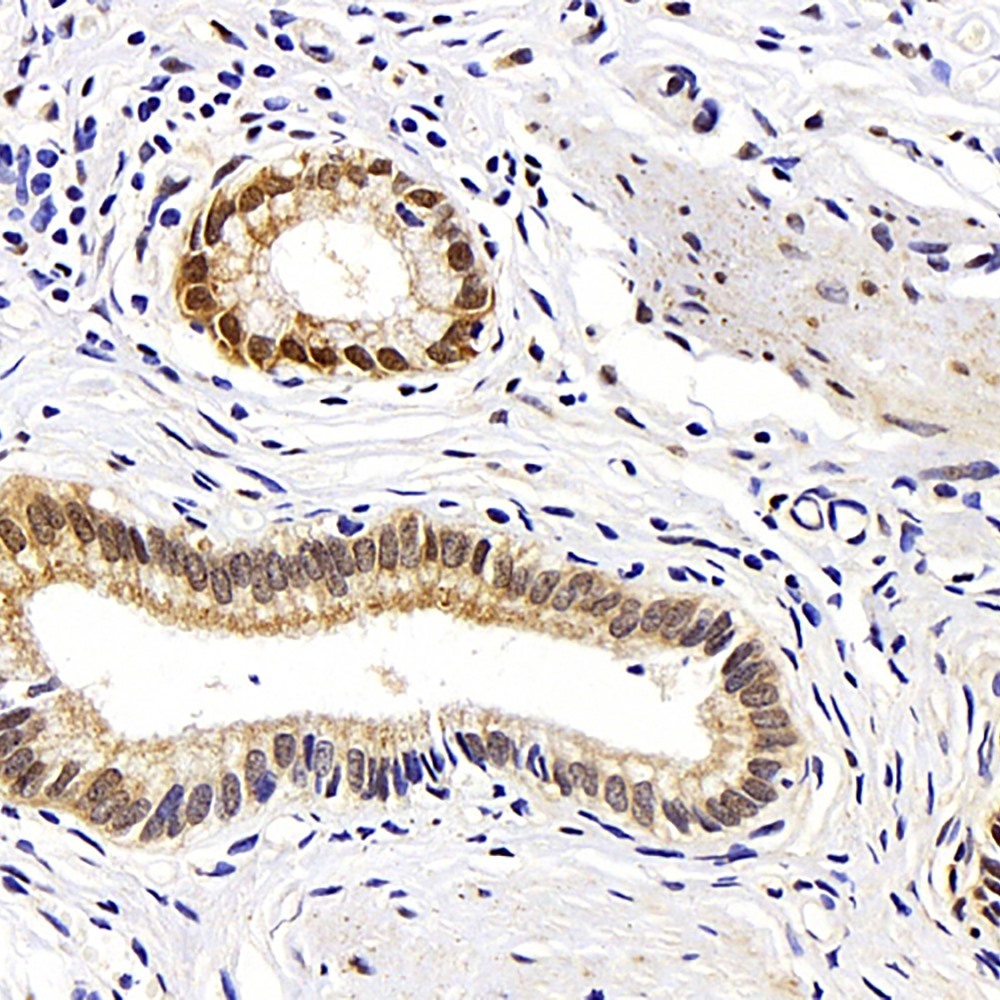 Immunohistochemistry analysis of paraffin-embedded human gallbladder  using HSPA1A Polyclonal Antibody at dilution of 1:500.