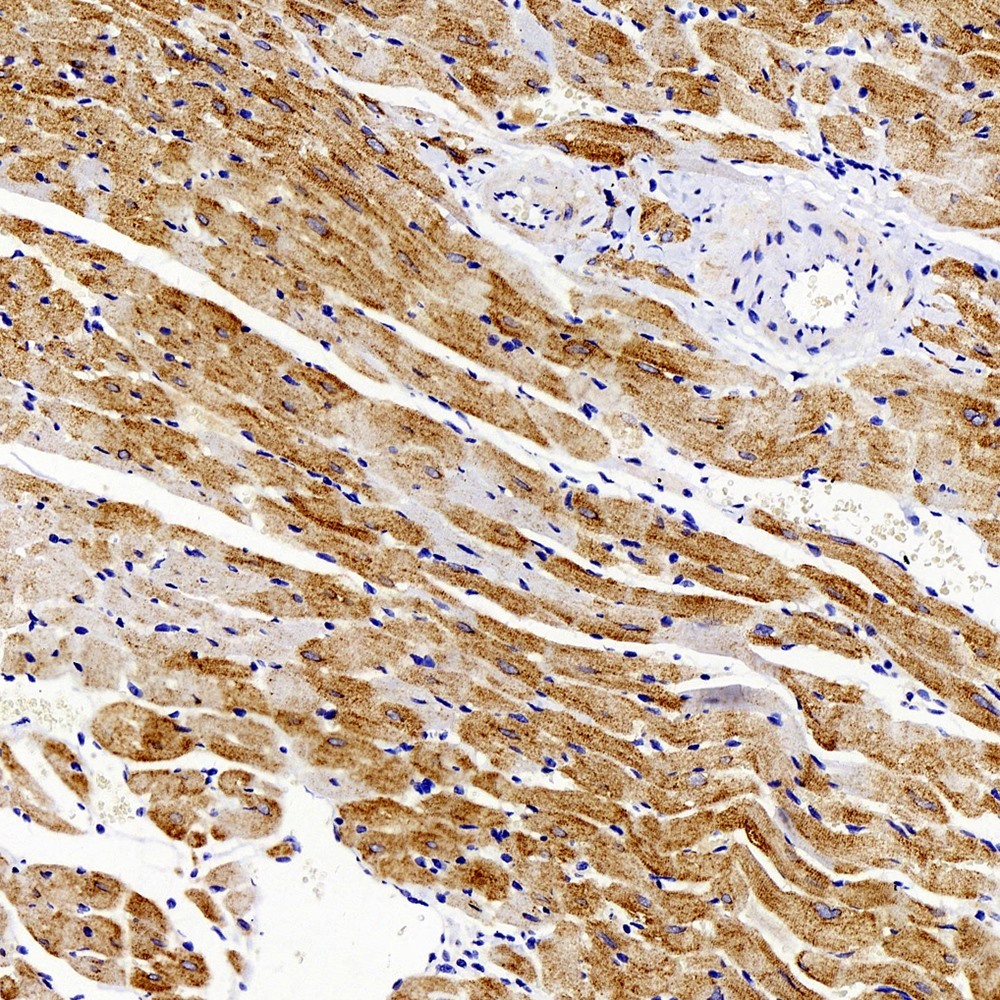 Immunohistochemistry analysis of paraffin-embedded mouse skeletal muscle  using GLUT-4 Polyclonal Antibody at dilution of 1:500.