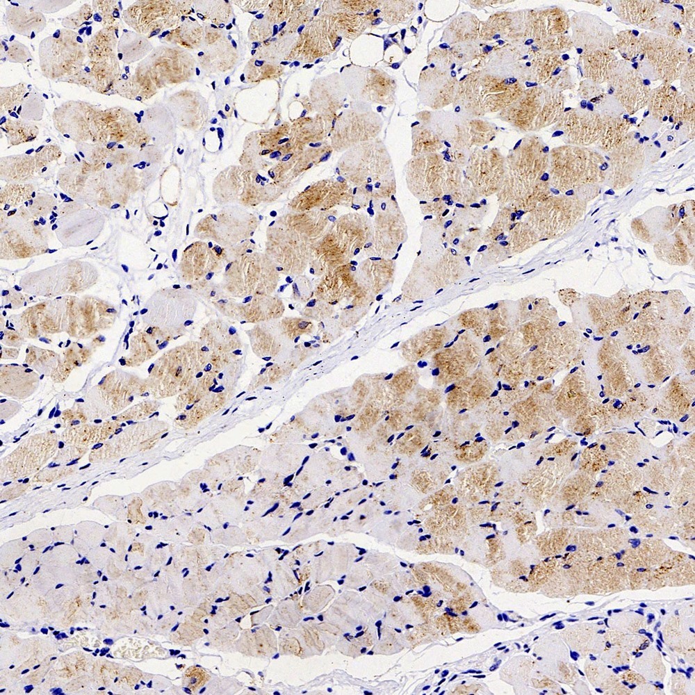 Immunohistochemistry analysis of paraffin-embedded rat skeletal muscle  using GLUT-4 Polyclonal Antibody at dilution of 1:300.