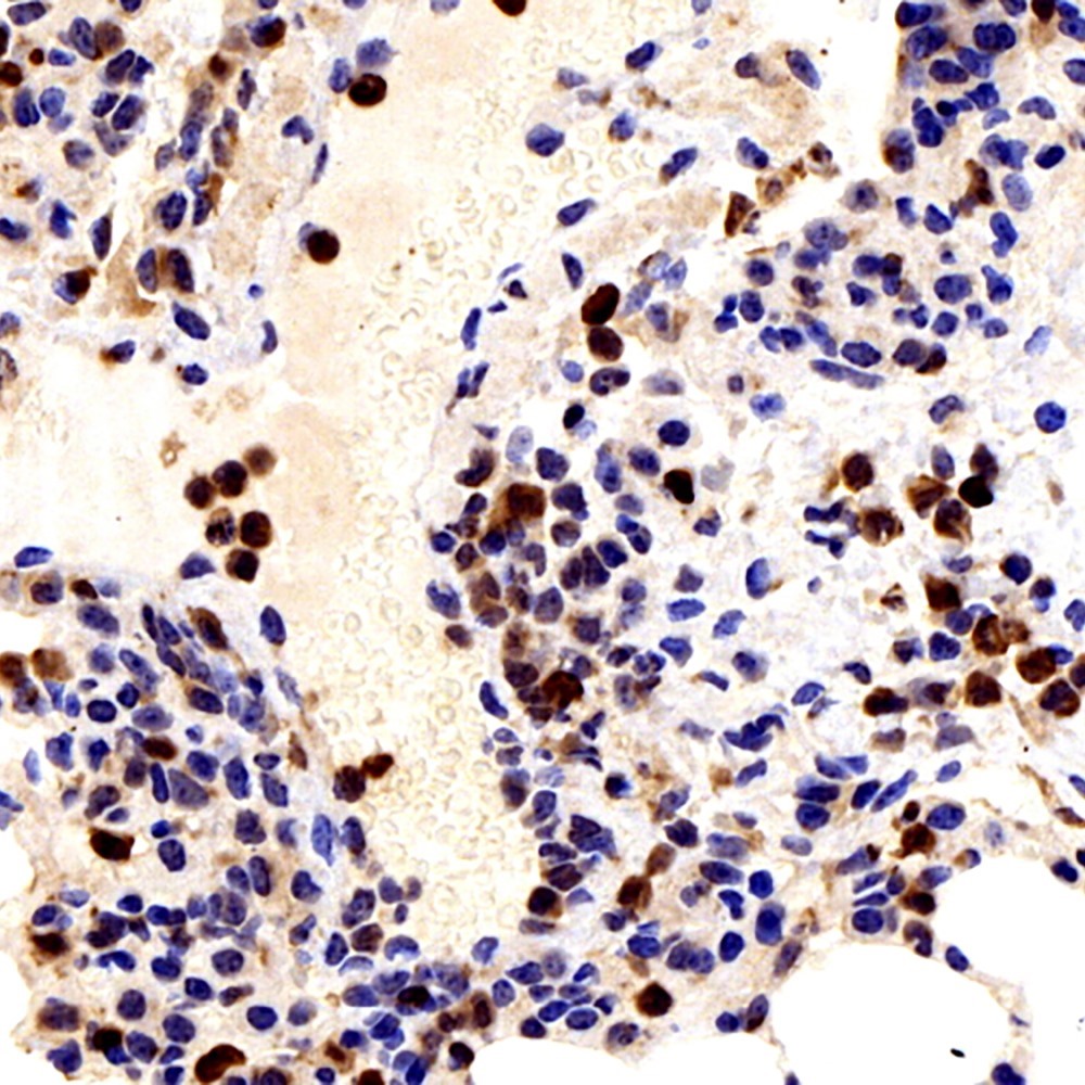 Immunohistochemistry analysis of paraffin-embedded mouse lung  using Galectin 3 Polyclonal Antibody at dilution of 1:300.