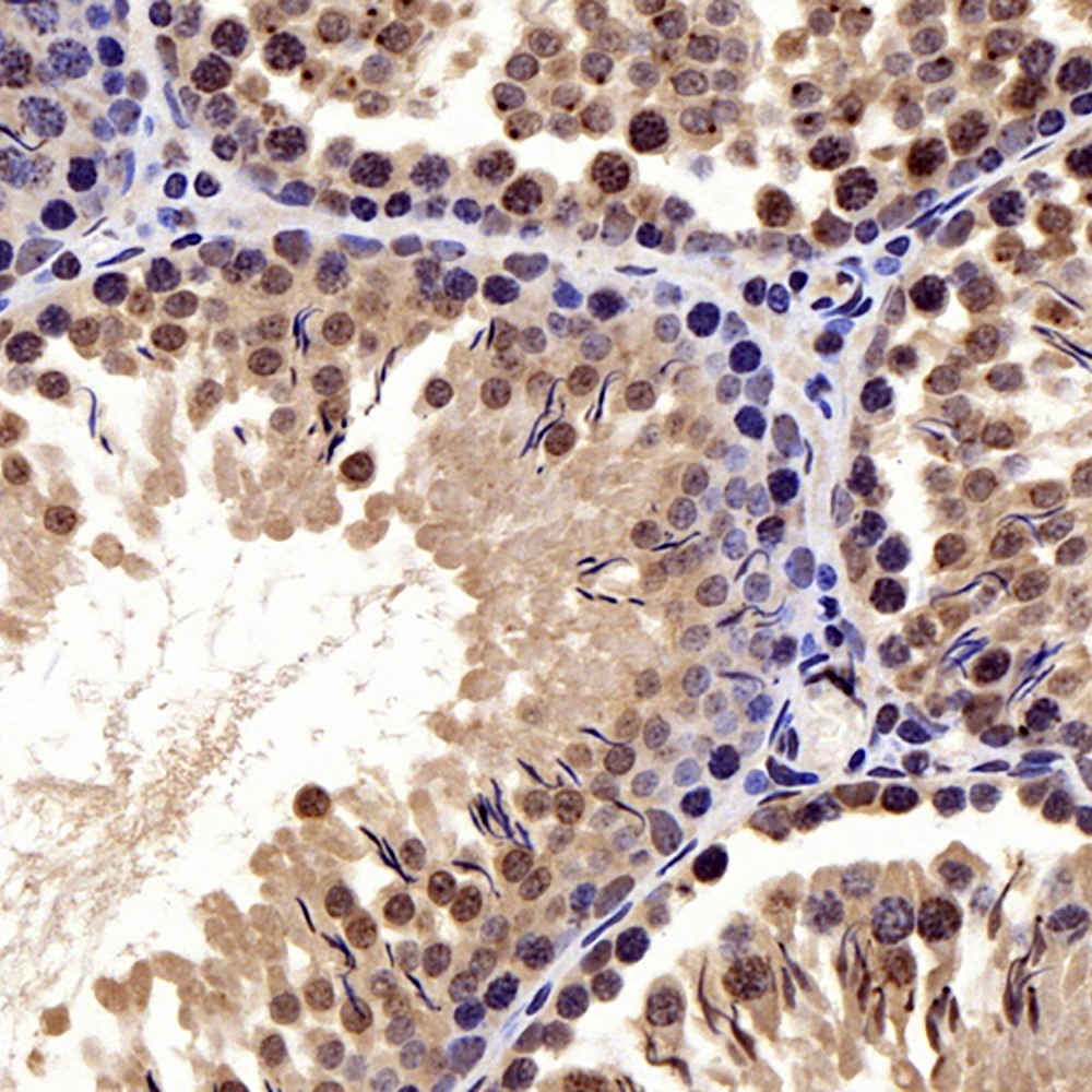 Immunohistochemistry analysis of paraffin-embedded rat testis  using AR Polyclonal Antibody at dilution of 1:300.