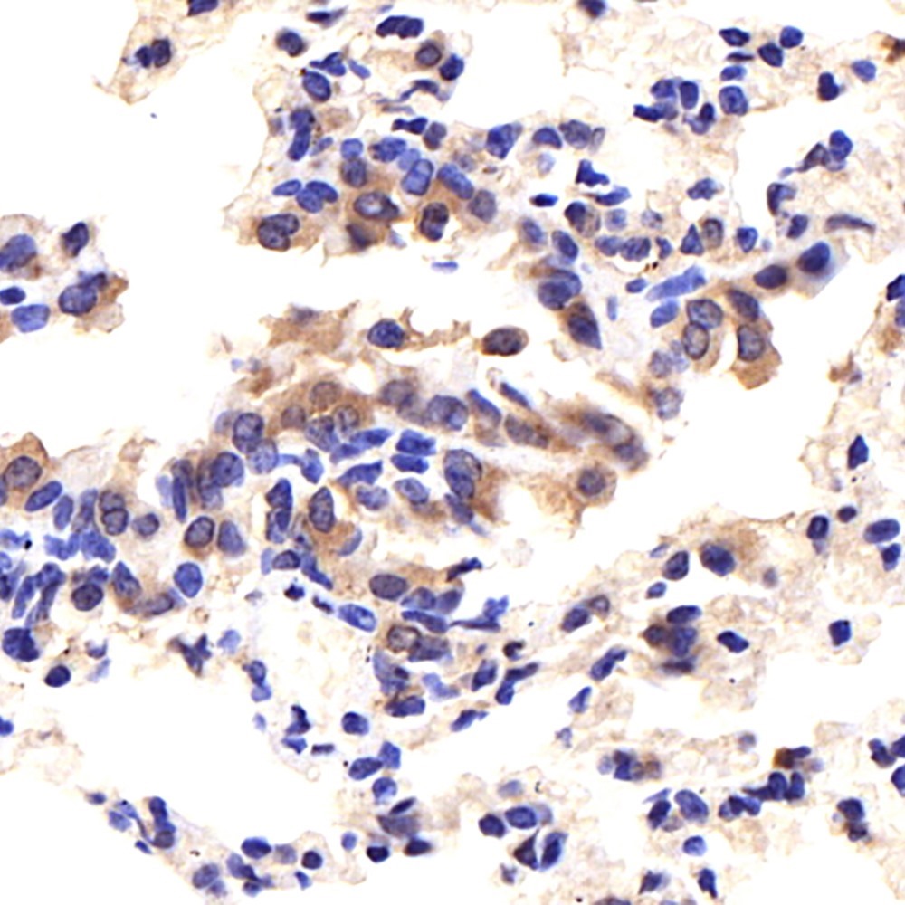 Immunohistochemistry analysis of paraffin-embedded mouse lung  using CD14 Polyclonal Antibody at dilution of 1:400.