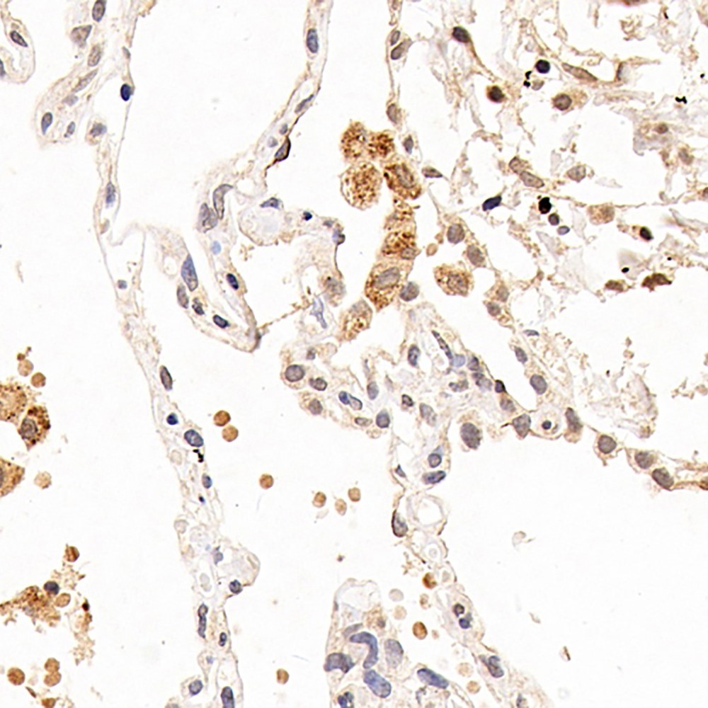 Immunohistochemistry analysis of paraffin-embedded human lung  using CXCR7 Polyclonal Antibody at dilution of 1:100.