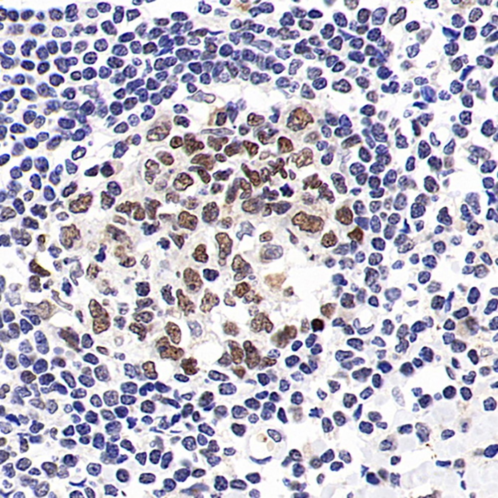 Immunohistochemistry analysis of paraffin-embedded Human tonsil  using SMARCA4 Polyclonal Antibody at dilution of 1:300.