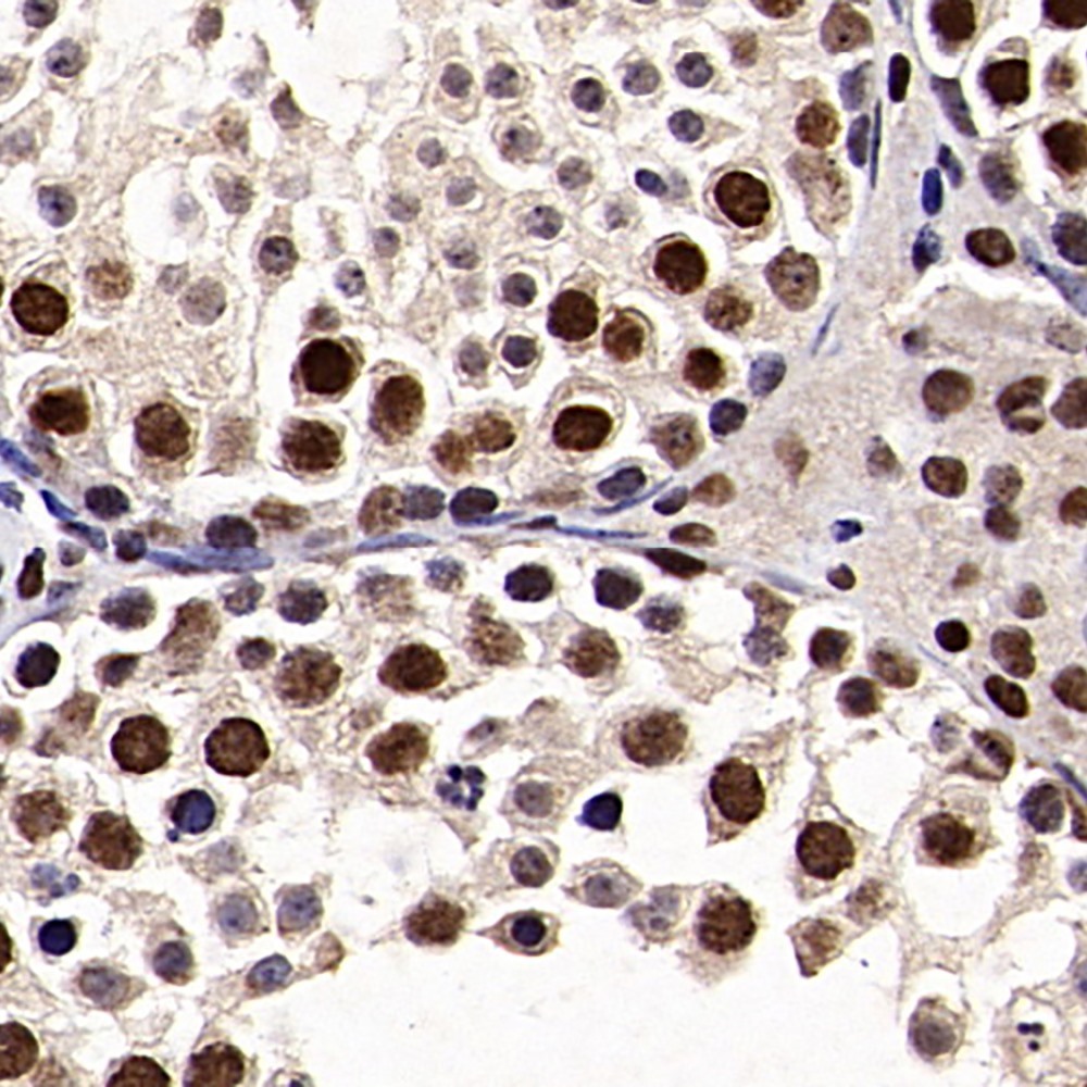 Immunohistochemistry analysis of paraffin-embedded mouse testis  using SMARCA4 Polyclonal Antibody at dilution of 1:300.