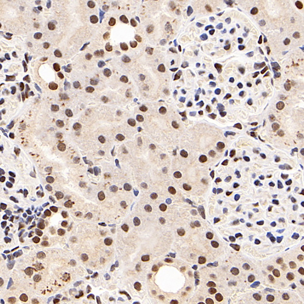 Immunohistochemistry analysis of paraffin-embedded rat kidney  using SMARCA4 Polyclonal Antibody at dilution of 1:200.