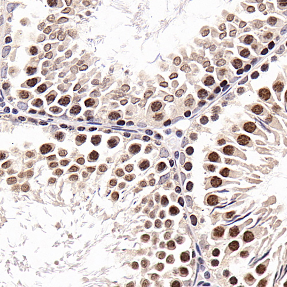 Immunohistochemistry analysis of paraffin-embedded Rat testis  using SNAI1 Polyclonal Antibody at dilution of 1:600.