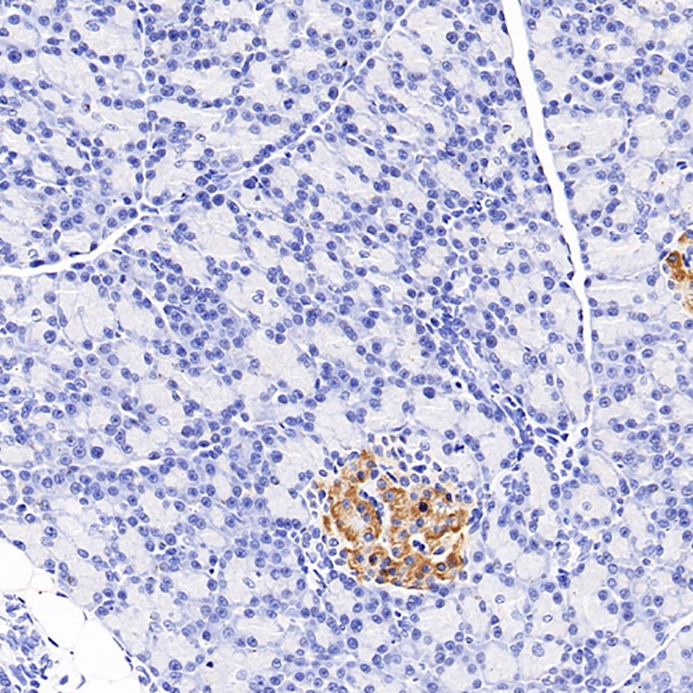 Immunohistochemistry analysis of paraffin-embedded Rat pancreas  using PDGFB Polyclonal Antibody at dilution of 1:200.