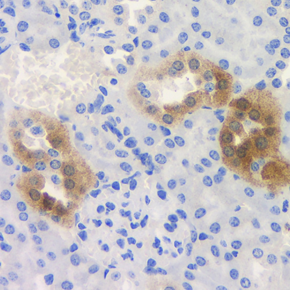 Immunohistochemistry analysis of paraffin-embedded mouse kidney  using ROCK1 Polyclonal Antibody at dilution of 1:300.