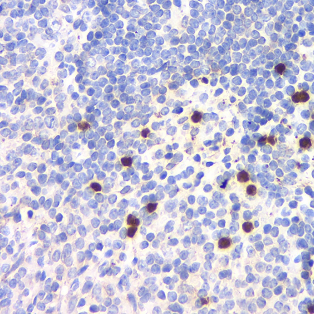 Immunohistochemistry analysis of paraffin-embedded mouse spleen  using TLR9 Polyclonal Antibody at dilution of 1:200.