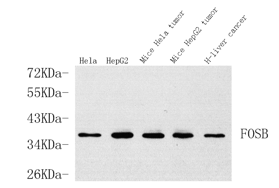 Western Blot analysis of various samples using FOSB Polyclonal Antibody at dilution of 1:1000.