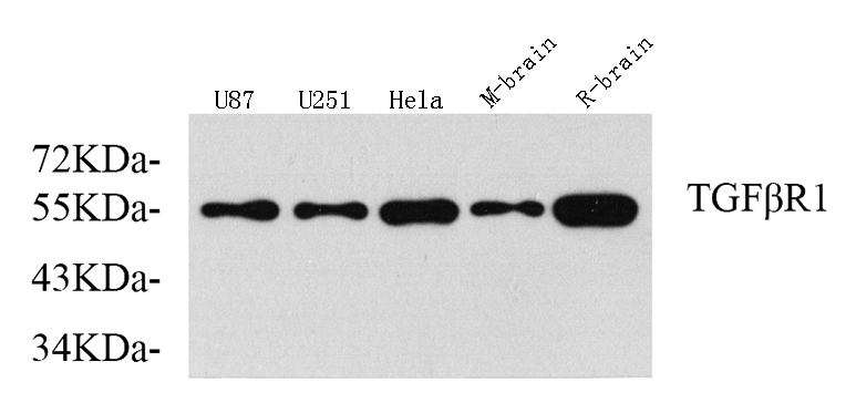 Western Blot analysis of various samples using TGF β Receptor I Polyclonal Antibody at dilution of 1:750.