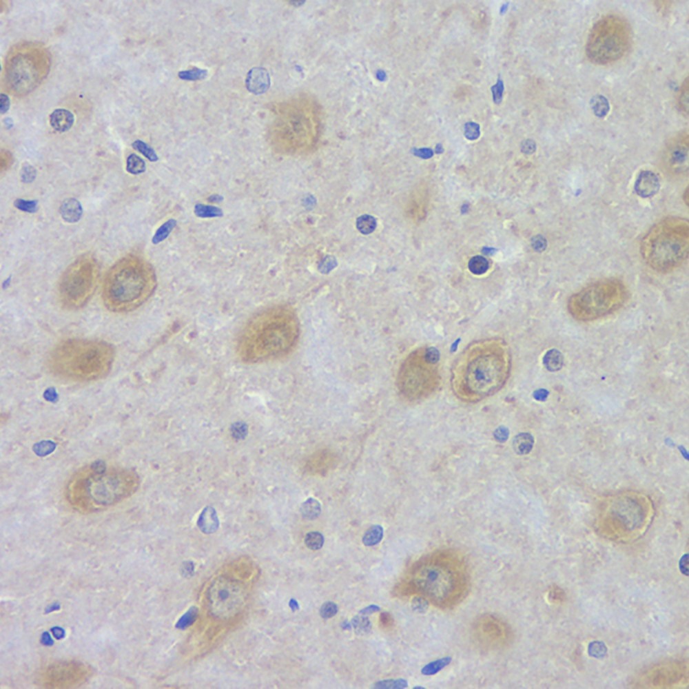 Immunohistochemistry analysis of paraffin-embedded rat brain  using DLG4 Polyclonal Antibody at dilution of 1:100.