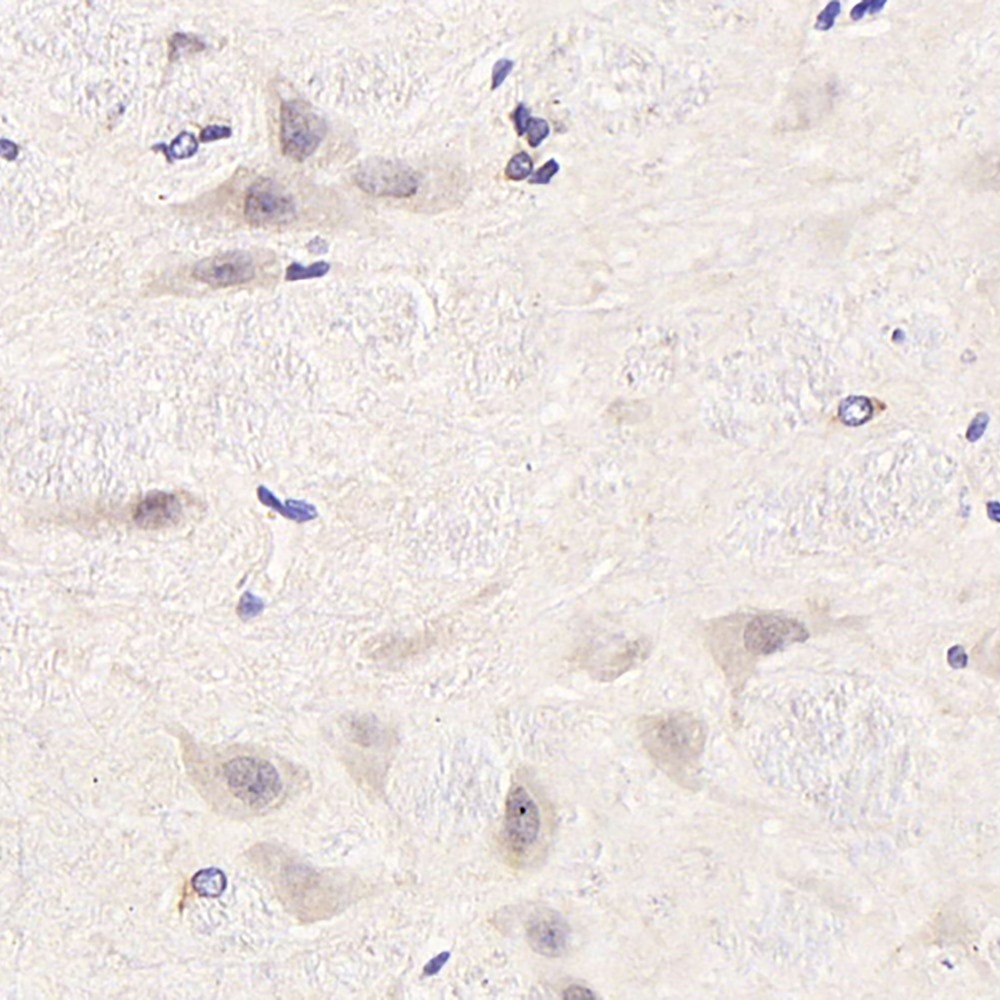 Immunohistochemistry analysis of paraffin-embedded rat brain  using CDC25A Polyclonal Antibody at dilution of 1:1000.