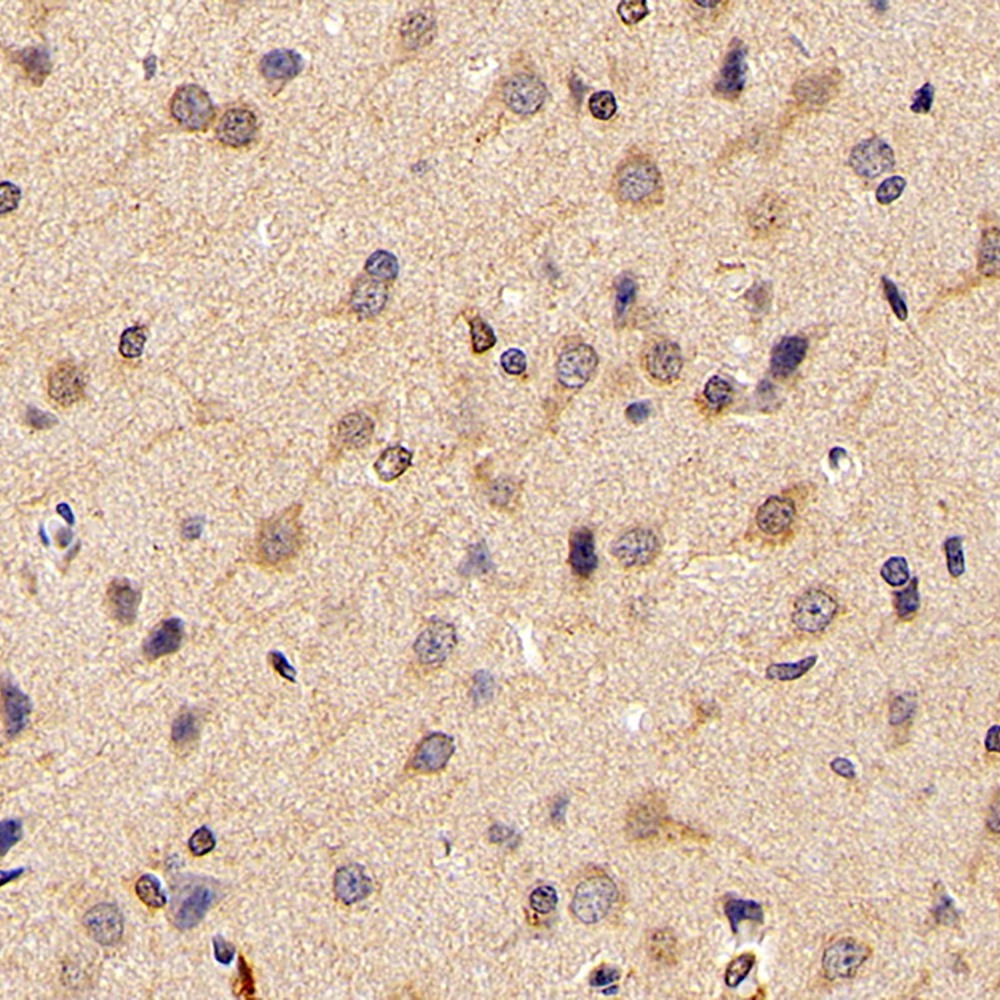 Immunohistochemistry analysis of paraffin-embedded rat brain  using FOXO1 Polyclonal Antibody at dilution of 1:300.