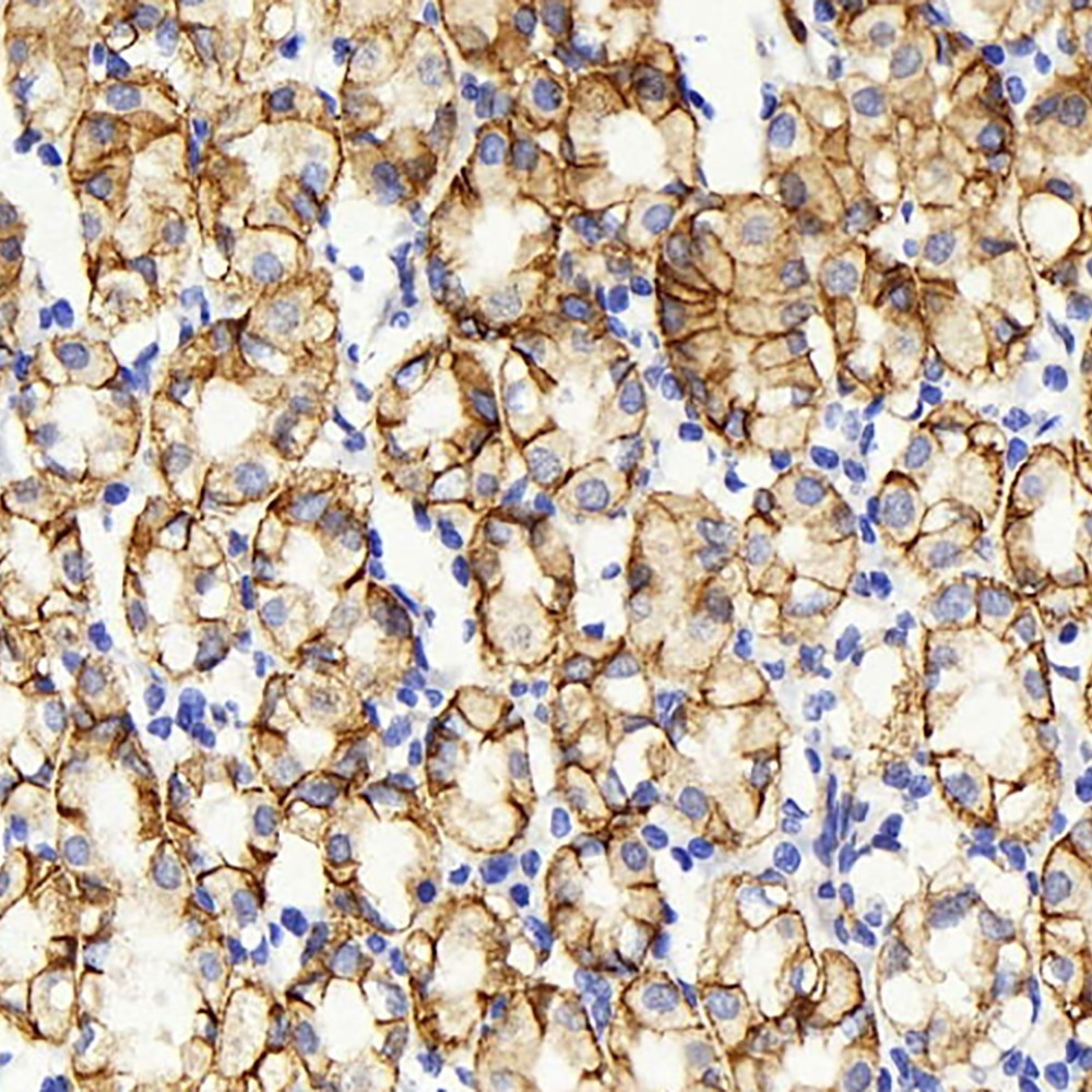 Immunohistochemistry analysis of paraffin-embedded human stomach  using Claudin 5 Polyclonal Antibody at dilution of 1:400.