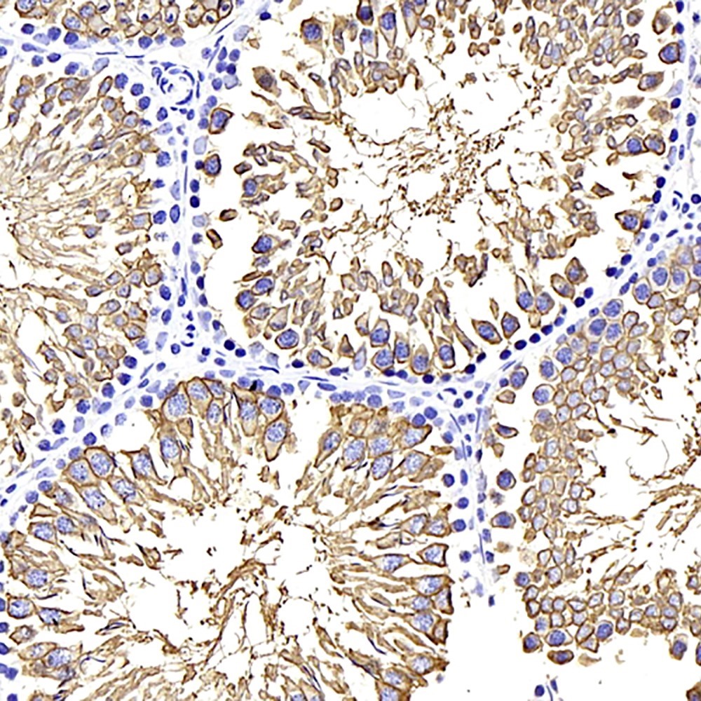 Immunohistochemistry analysis of paraffin-embedded rat testis  using GLUT-3 Polyclonal Antibody at dilution of 1:400.