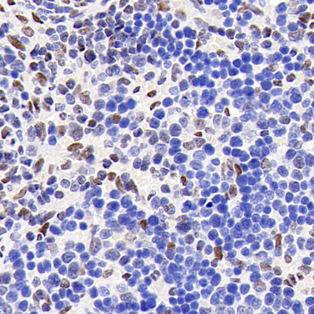 Immunohistochemistry analysis of paraffin-embedded rat spleen  using Glucocorticoid Receptor Polyclonal Antibody at dilution of 1:1000.