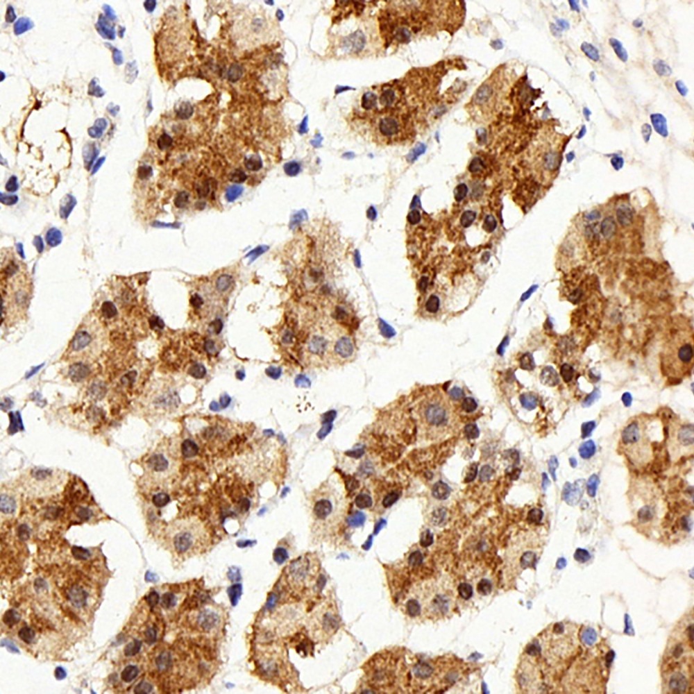 Immunohistochemistry analysis of paraffin-embedded human stomach  using IL22RA1 Polyclonal Antibody at dilution of 1:200.