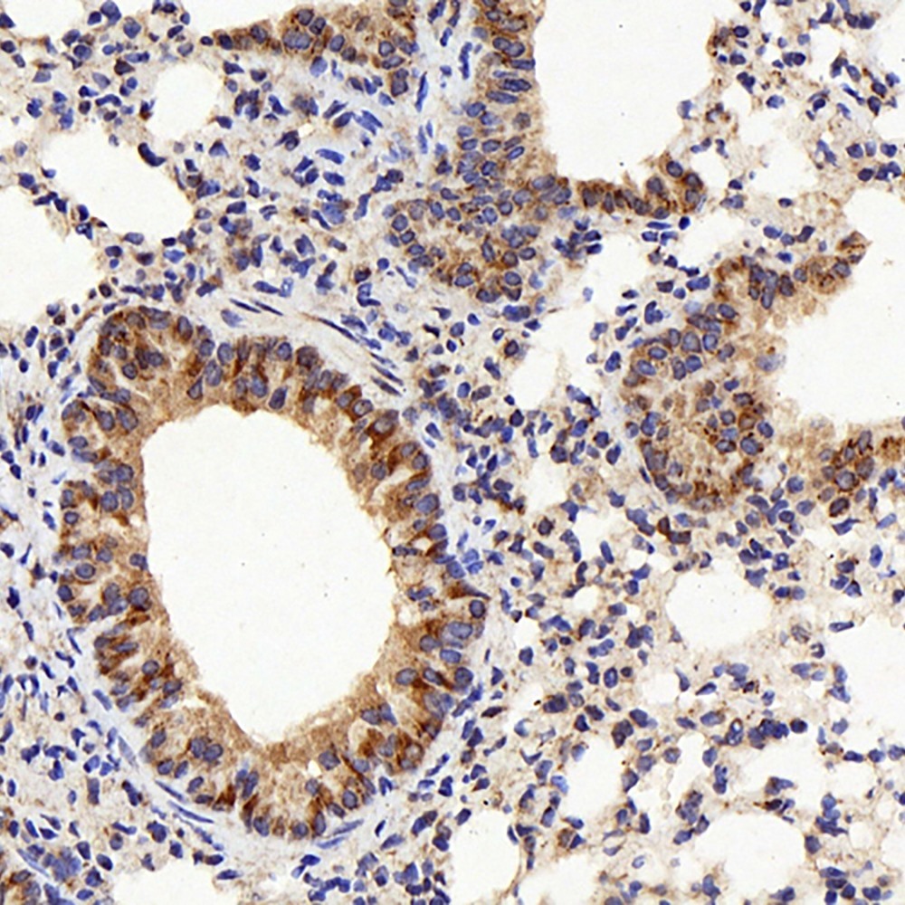 Immunohistochemistry analysis of paraffin-embedded mouse lung  using IL22RA1 Polyclonal Antibody at dilution of 1:200.