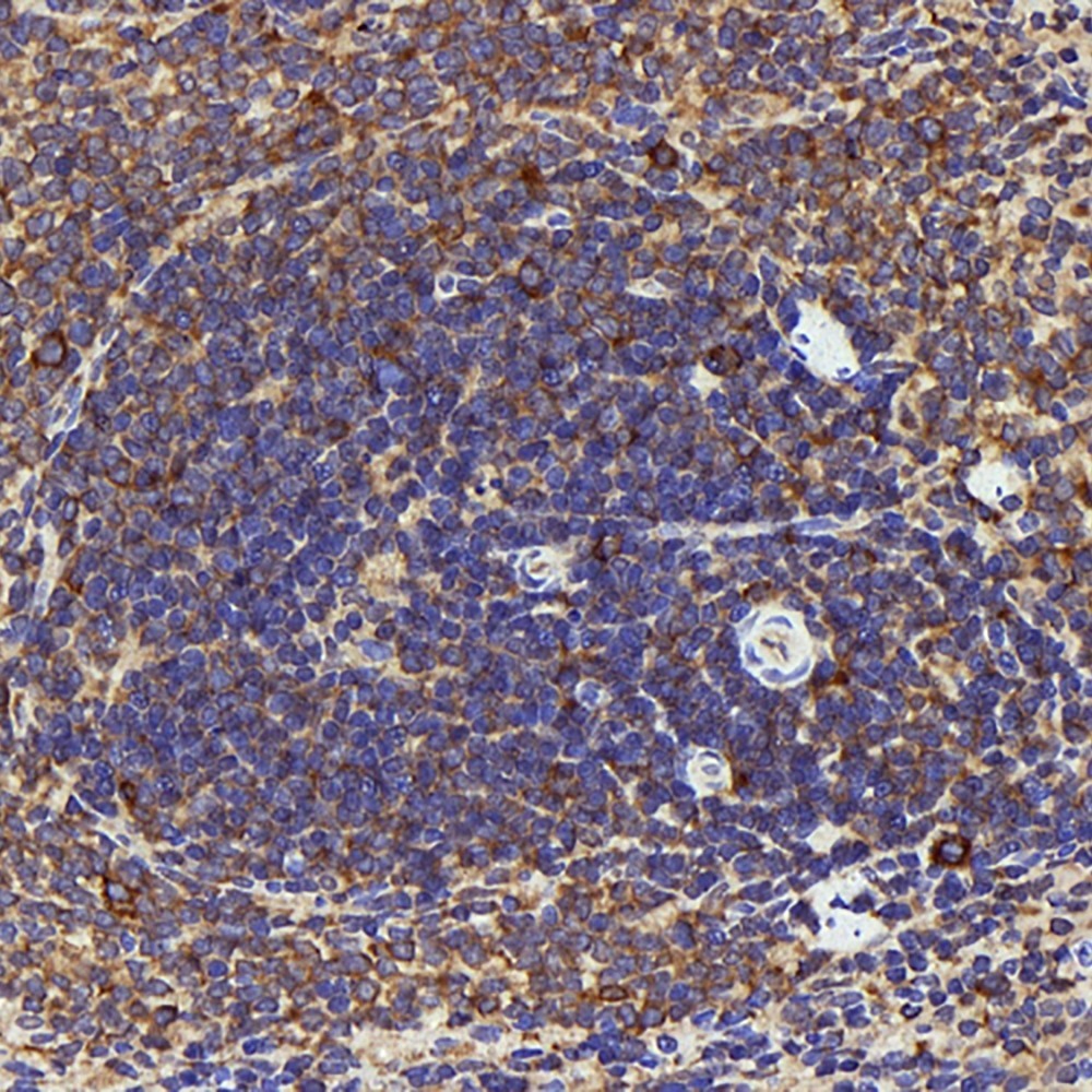 Immunohistochemistry analysis of paraffin-embedded Rat spleen  using IL22RA1 Polyclonal Antibody at dilution of 1:200.