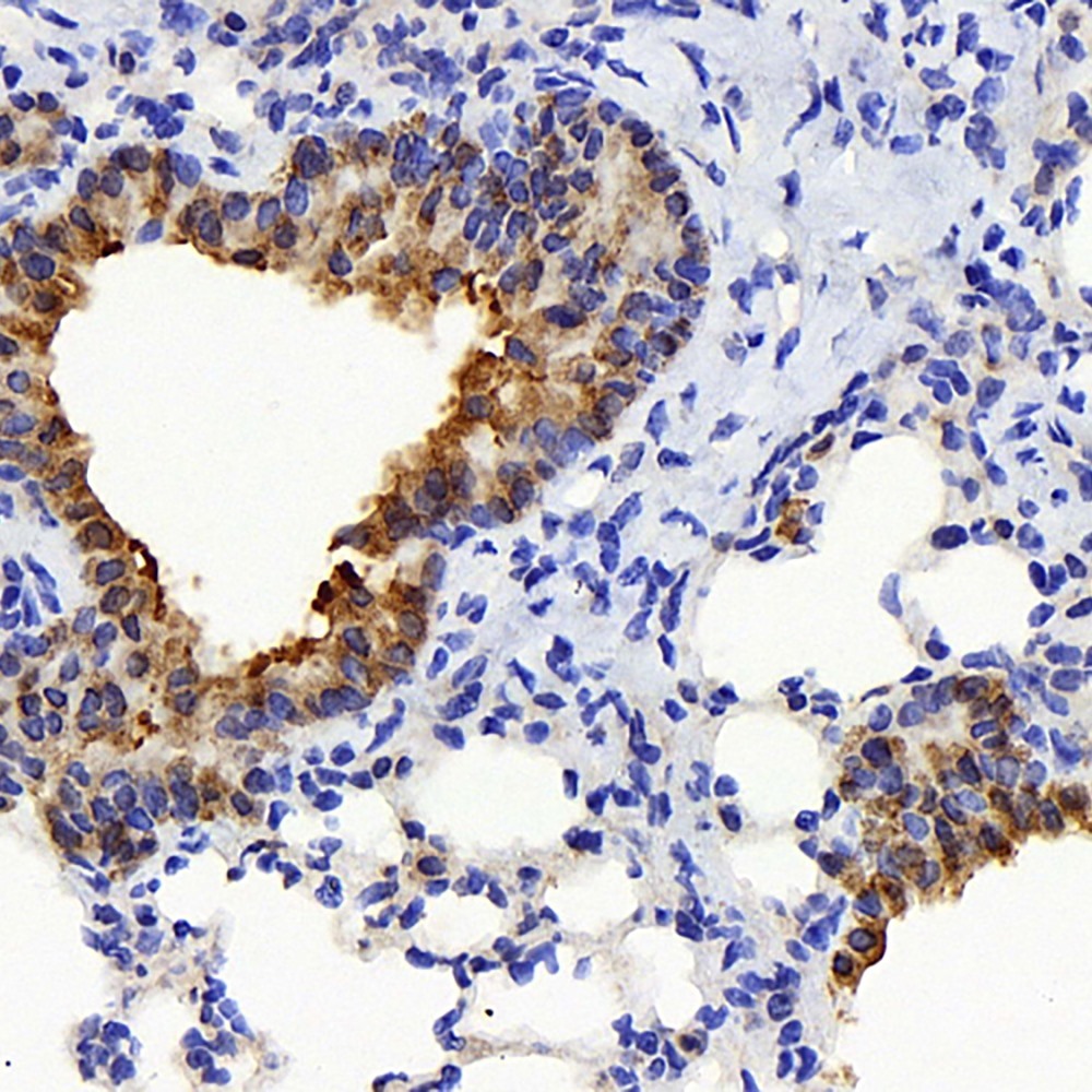 Immunohistochemistry analysis of paraffin-embedded mouse lung  using TSC22D3 Polyclonal Antibody at dilution of 1:300.