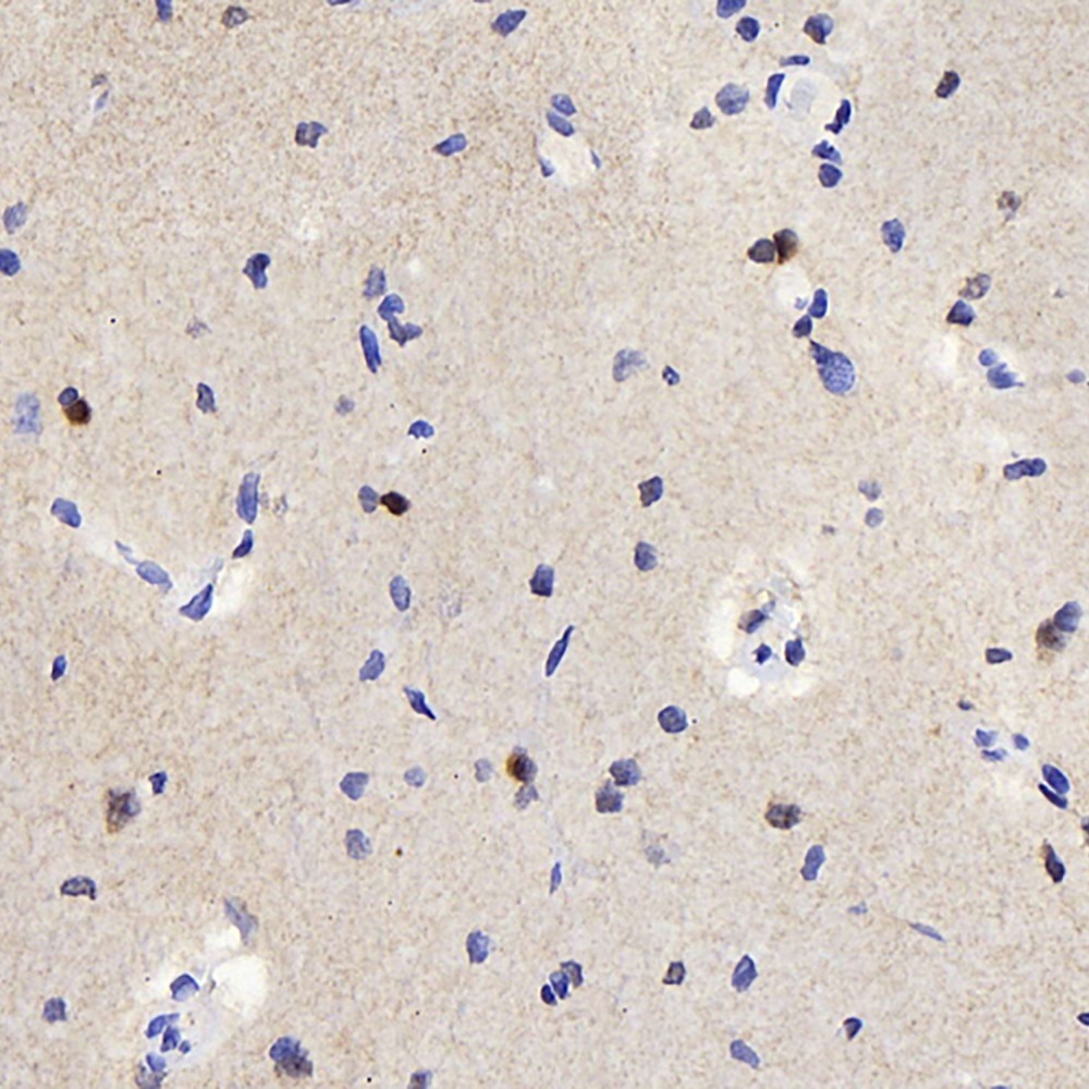 Immunohistochemistry analysis of paraffin-embedded rat brain  using TSC22D3 Polyclonal Antibody at dilution of 1:300.