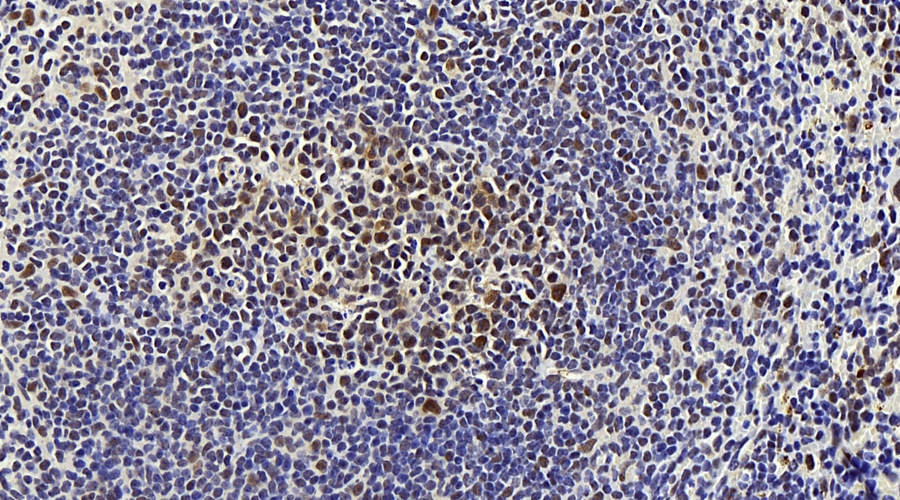 Immunohistochemistry analysis of paraffin-embedded mouse spleen  using MAP2K1 Polyclonal Antibody at dilution of 1:100.