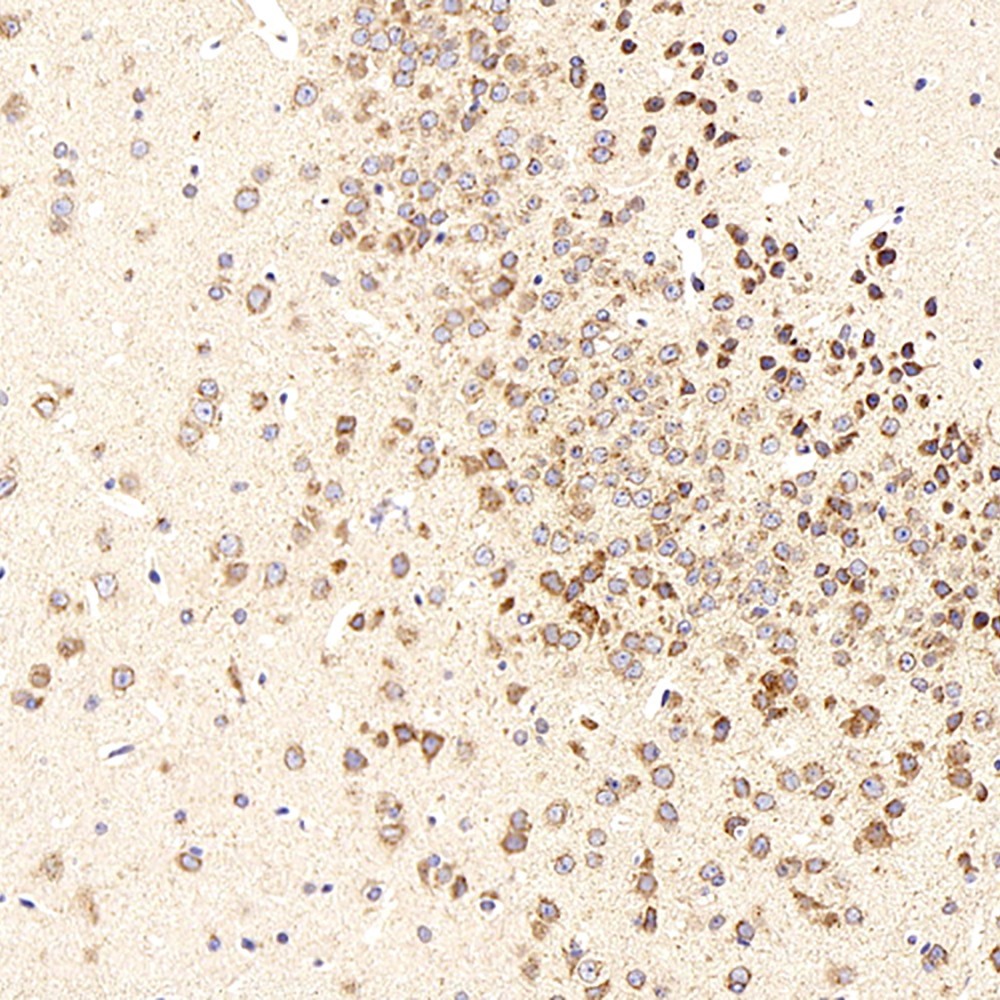 Immunohistochemistry analysis of paraffin-embedded mouse brain  using beta Amyloid Polyclonal Antibody at dilution of 1:300.