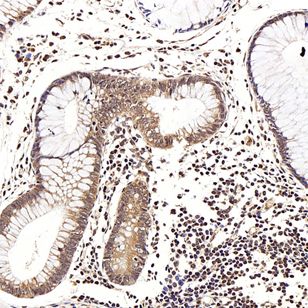 Immunohistochemistry analysis of paraffin-embedded human colon  using LEP Polyclonal Antibody at dilution of 1:100.