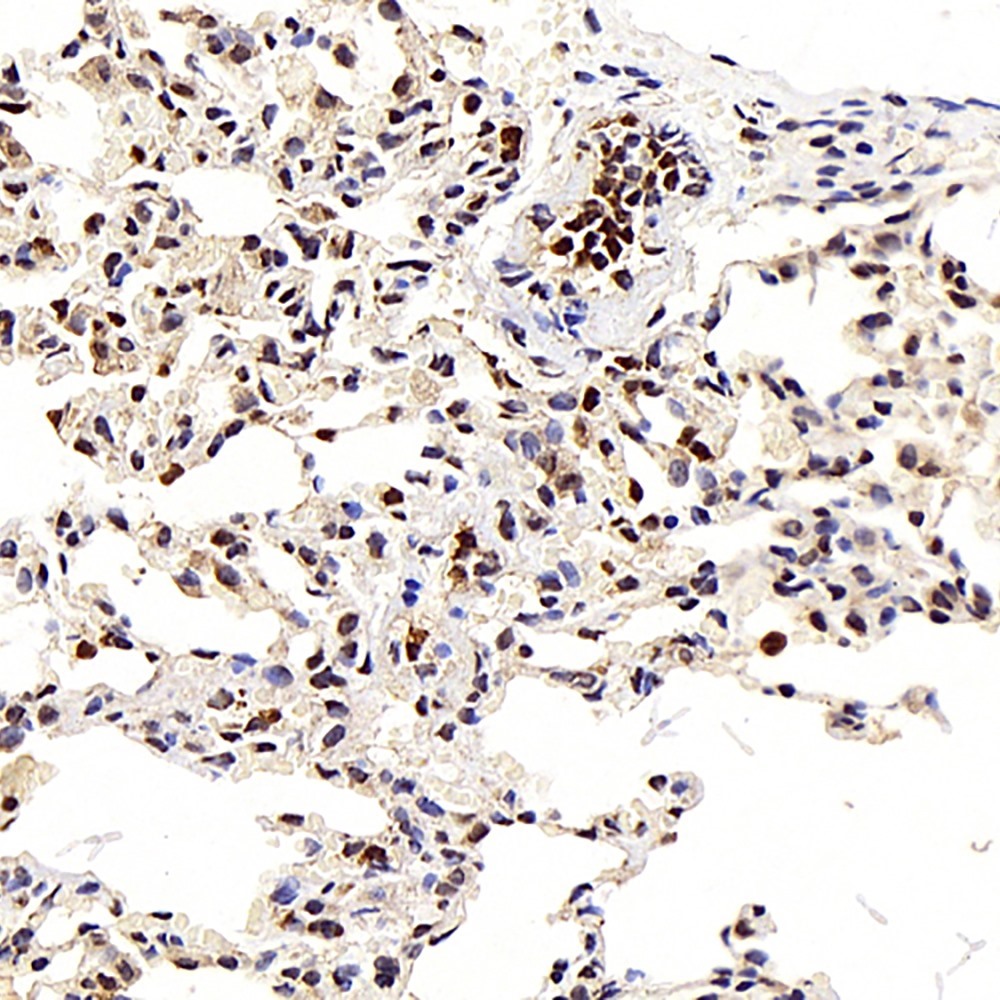 Immunohistochemistry analysis of paraffin-embedded Rat lung  using LEP Polyclonal Antibody at dilution of 1:100.