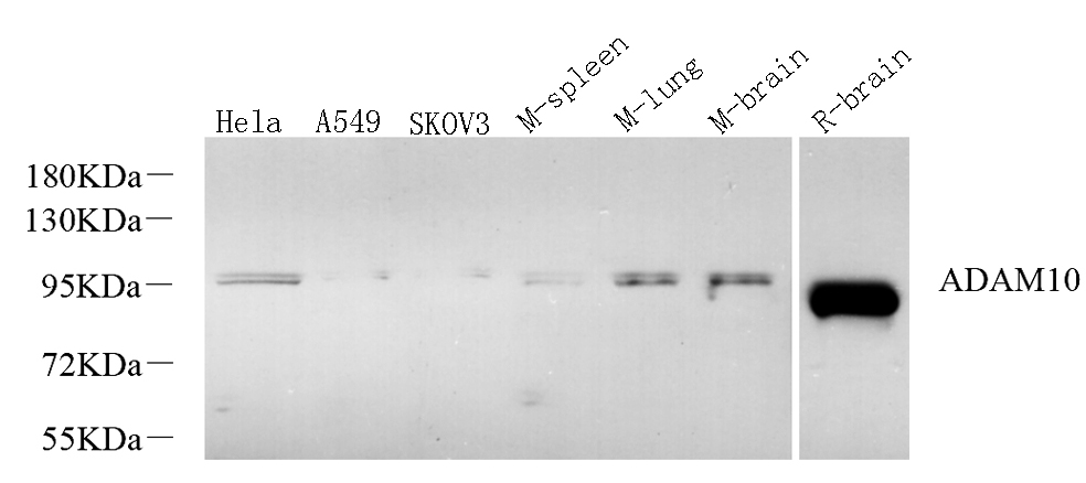 Western Blot analysis of various samples using CD156c Polyclonal Antibody at dilution of 1:600.