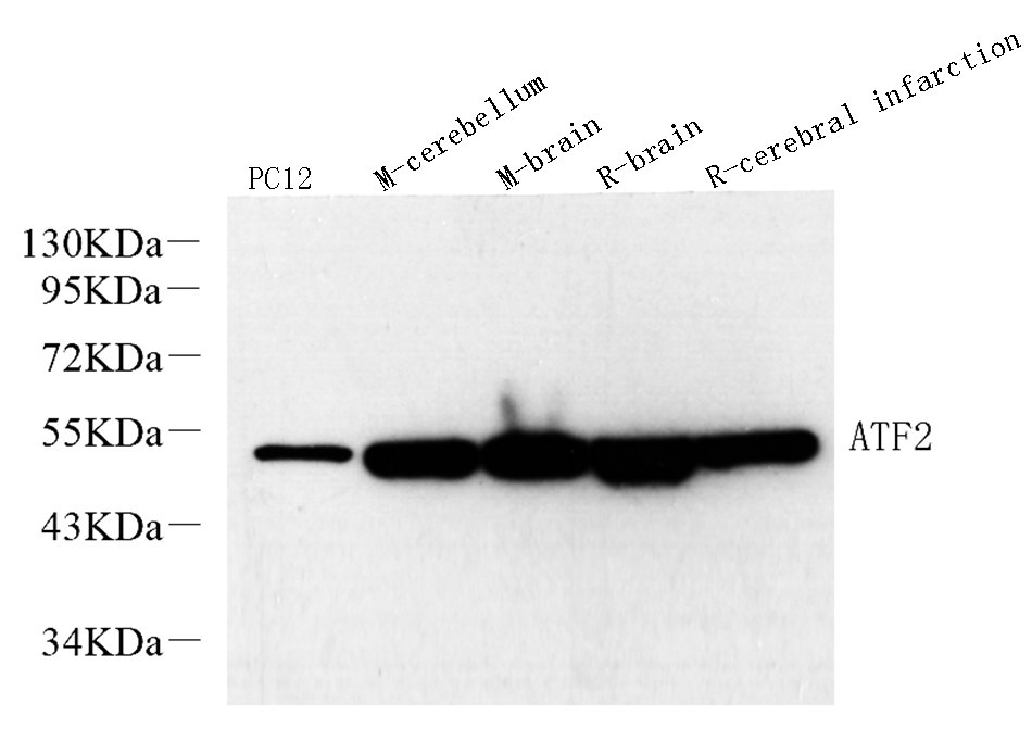 Western Blot analysis of various samples using ATF2 Polyclonal Antibody at dilution of 1:600.