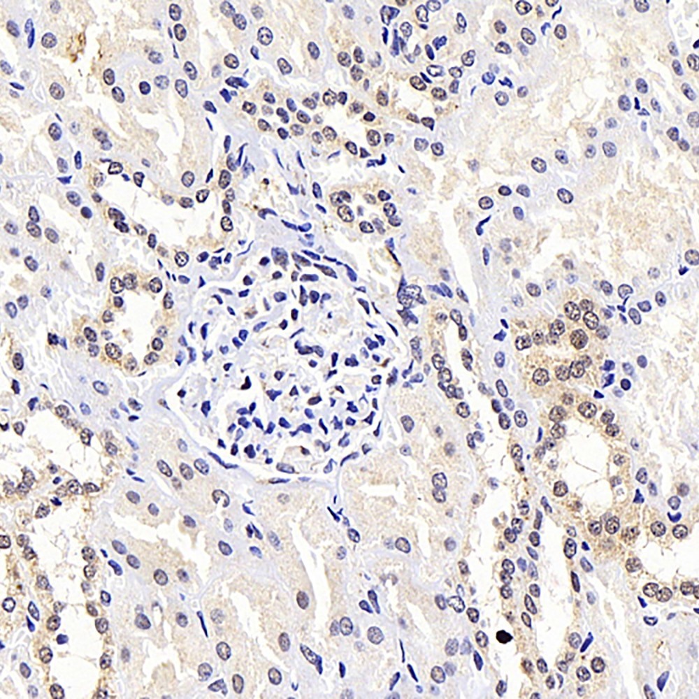 Immunohistochemistry analysis of paraffin-embedded human kidney  using ATF2 Polyclonal Antibody at dilution of 1:400.