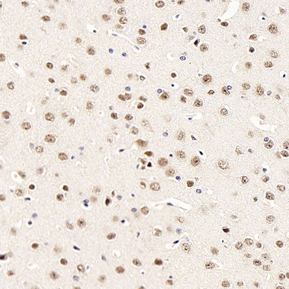 Immunohistochemistry analysis of paraffin-embedded mouse brain  using ATF2 Polyclonal Antibody at dilution of 1:400.