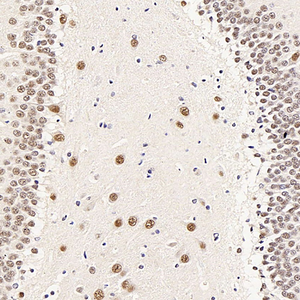 Immunohistochemistry analysis of paraffin-embedded rat brain  using ATF2 Polyclonal Antibody at dilution of 1:400.