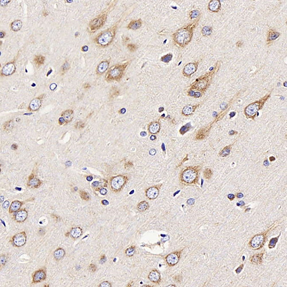 Immunohistochemistry analysis of paraffin-embedded Rat brain  using DCX Polyclonal Antibody at dilution of 1:400.