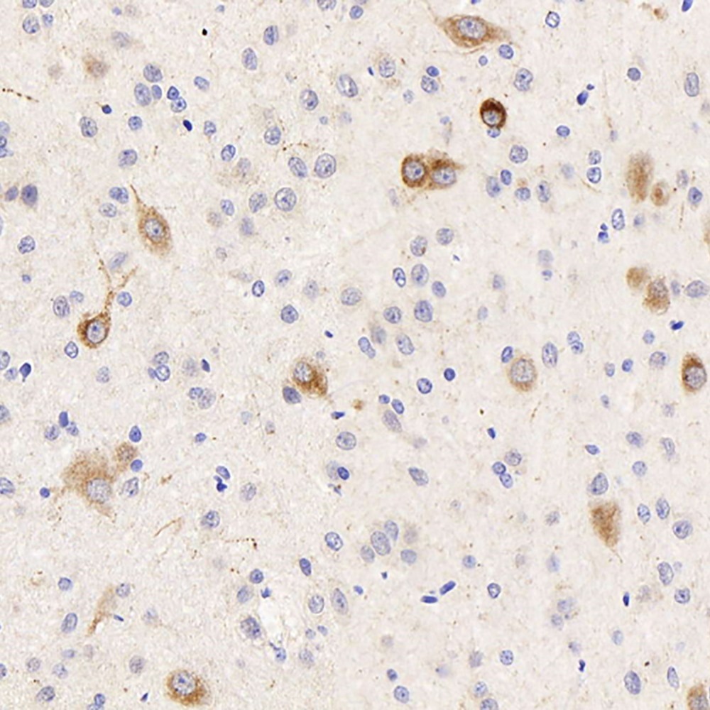 Immunohistochemistry analysis of paraffin-embedded rat brain  using DLL3 Polyclonal Antibody at dilution of 1:300.