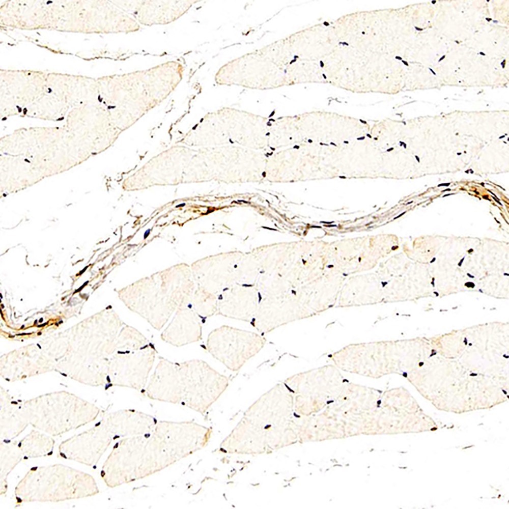 Immunohistochemistry analysis of paraffin-embedded rat skeletal muscle  using DLL4 Polyclonal Antibody at dilution of 1:200.