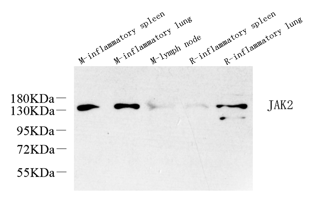 Western Blot analysis of various samples using JAK2 Polyclonal Antibody at dilution of 1:1000.