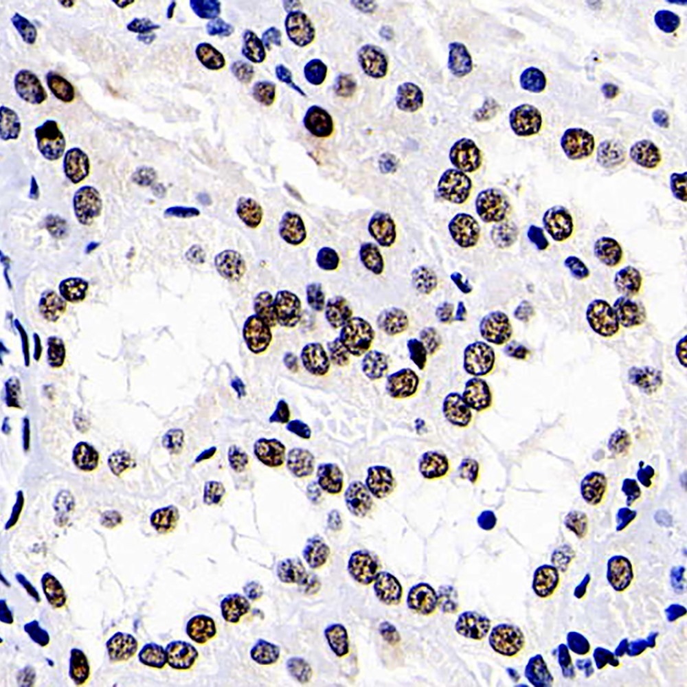 Immunohistochemistry analysis of paraffin-embedded human kidney   using DNMT1 Polyclonal Antibody at dilution of 1:300.