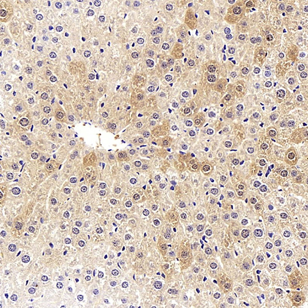 Immunohistochemistry analysis of paraffin-embedded mouse liver  using COL18A1 Polyclonal Antibody at dilution of 1:400.