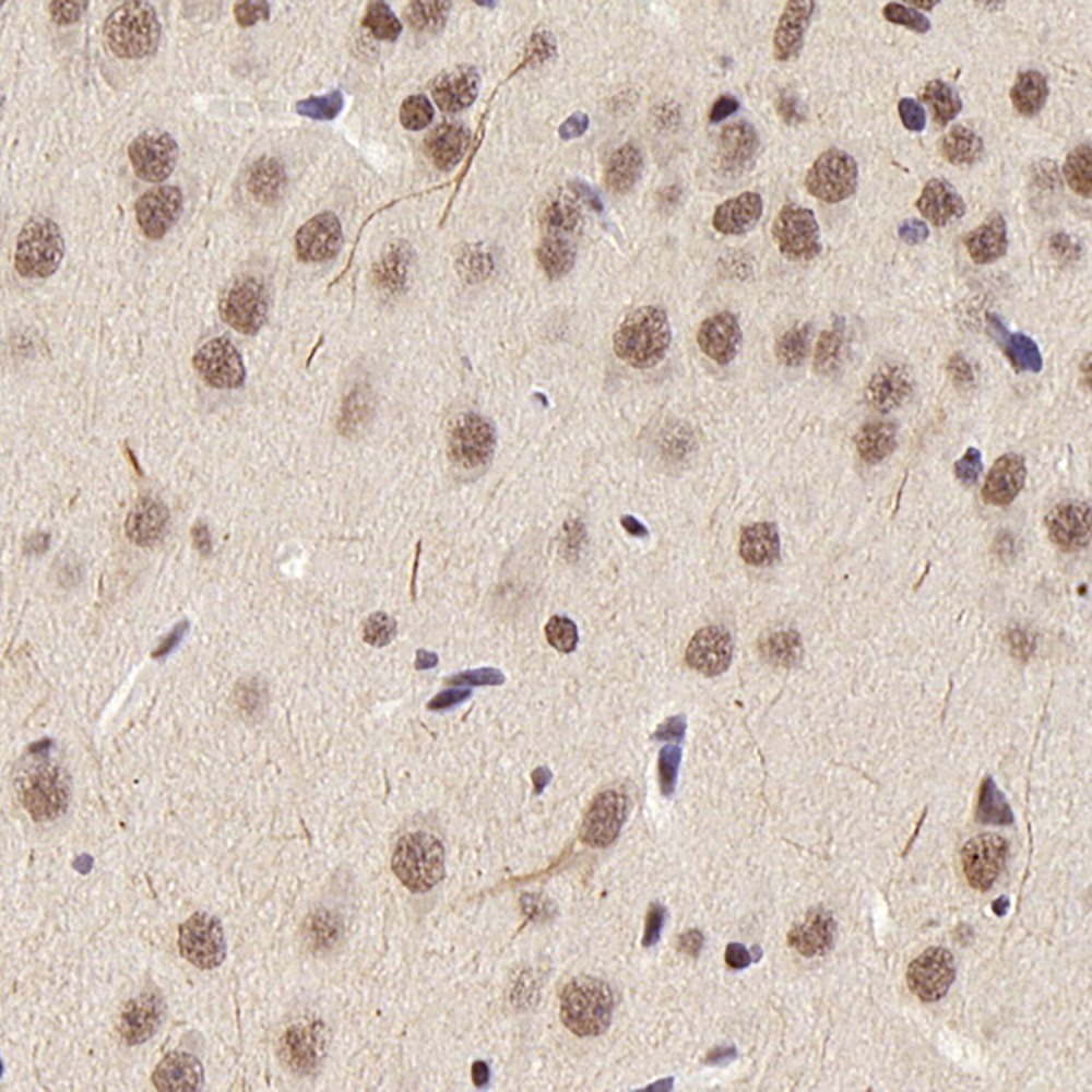 Immunohistochemistry analysis of paraffin-embedded rat brain  using HDAC1 Polyclonal Antibody at dilution of 1:300.