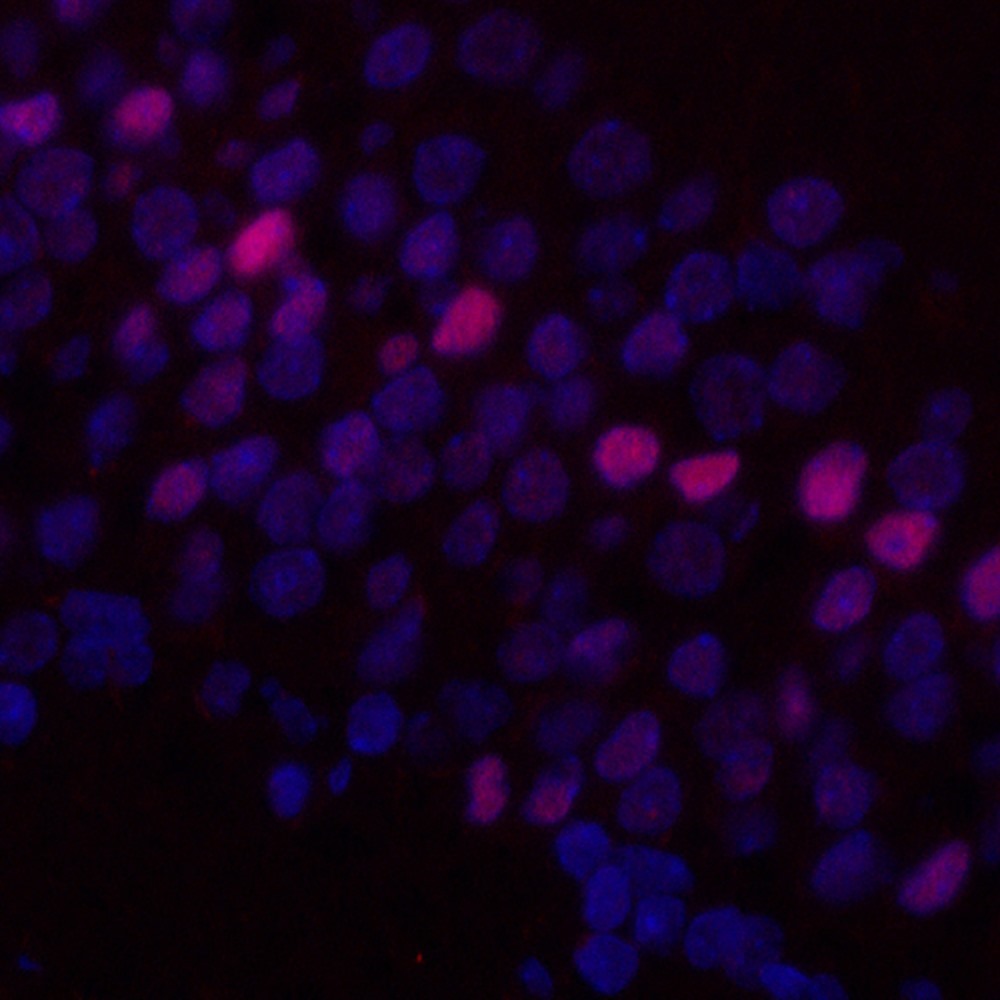 Immunofluorescence analysis of paraffin-embedded rat brain  using c-Fos Monoclonal Antibody at dilution of 1:400.