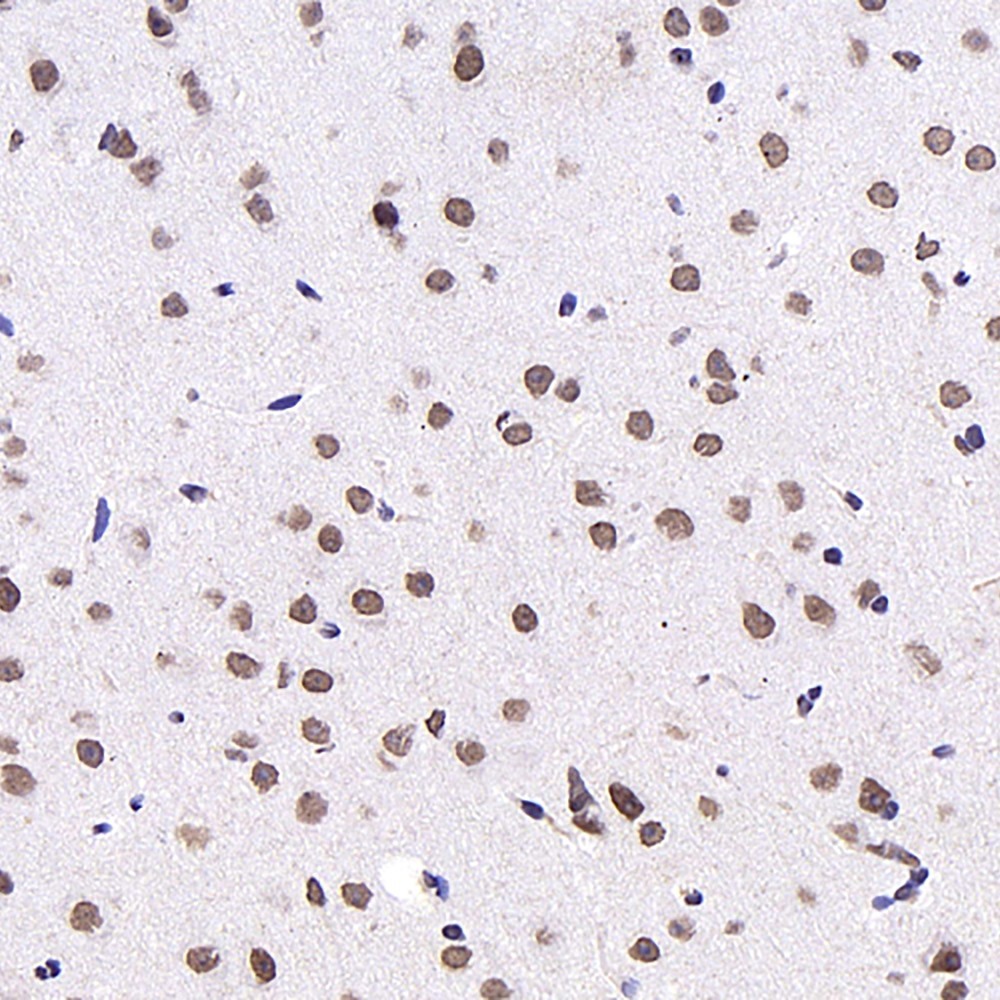 Immunohistochemistry analysis of paraffin-embedded mouse brain  using c-Fos Monoclonal Antibody at dilution of 1:1000.