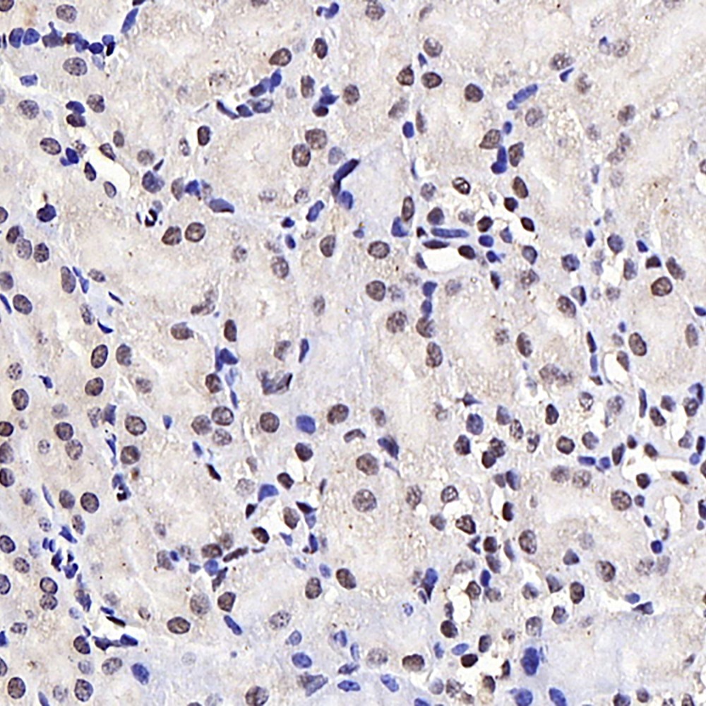 Immunohistochemistry analysis of paraffin-embedded mouse kidney  using JMJD6 Polyclonal Antibody at dilution of 1:1000.