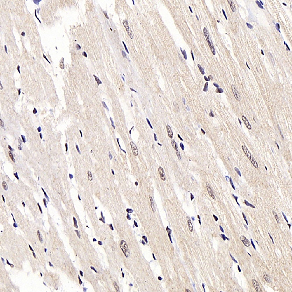 Immunohistochemistry analysis of paraffin-embedded rat heart  using JMJD6 Polyclonal Antibody at dilution of 1:1000.