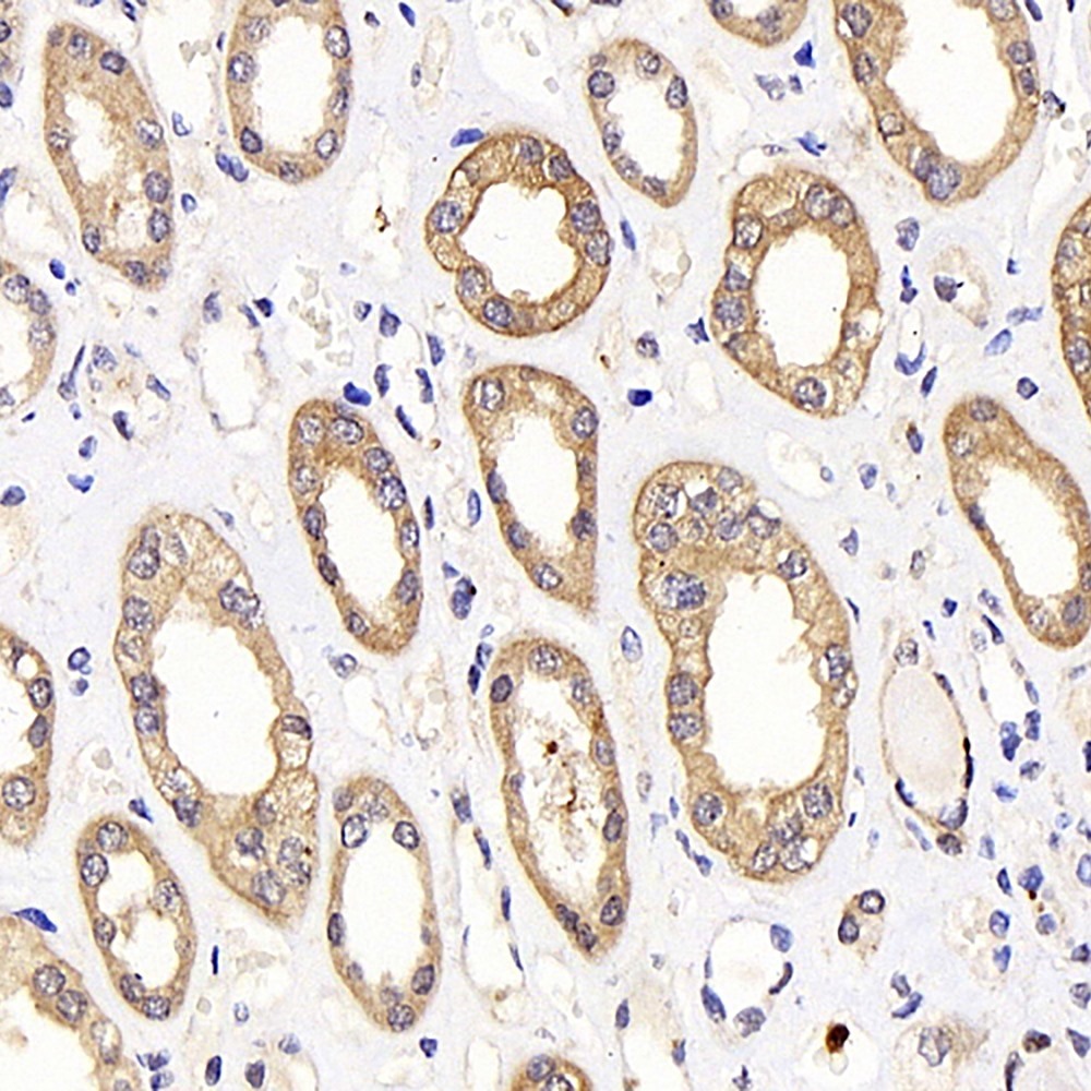 Immunohistochemistry analysis of parafffin-embedded human kideny  using LDHA Polyclonal Antibody at dilution of 1:1000.